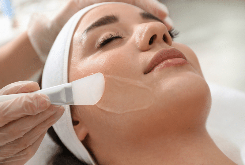 Peeling de Fenol Atenuado e Tamponado