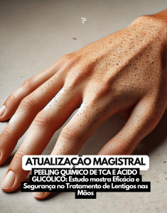 Tratamento Eficaz para Lentigos: Uma Abordagem Promissora com Peeling Químico