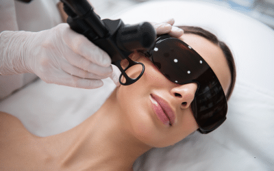 Tratamento Dermatológico com Lasers