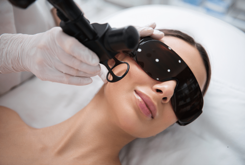 Tratamento Dermatológico com Lasers